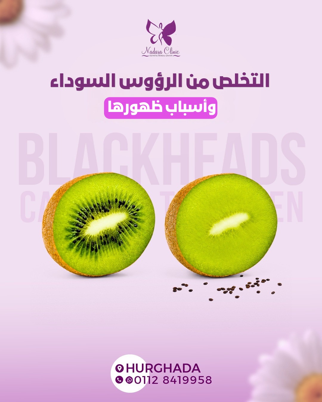 التخلص من الرؤوس السوداء في الغردقة